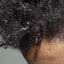 Imagem ilustrativa do cabelo de uma pessoa negra