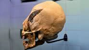 Crânio peruano foi doado para o Museu de Osteologia, nos Estados Unidos - Divulgação / Museu de Osteologia