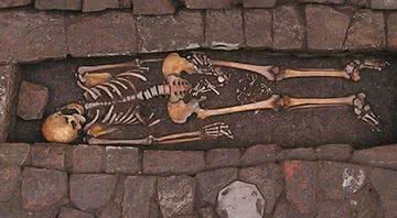 Fotografia do esqueleto com o feto entre as pernas - Divulgação/ World Neurosurgery