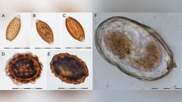 Imagem microscópica captura amostra de ovo de parasita - Divulgação / University of Copenhagen