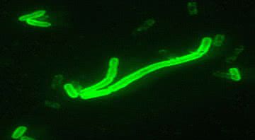 Yersinia pestis, bactéria que causa a peste bubônica - Wikipedia