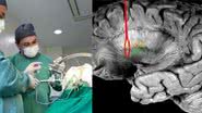 Imagens de procedimento cirúrgico inédito e raio-x onde é possível ver microchip - Divulgação/Arquivo Pessoal/Wuilker Knoner Campos