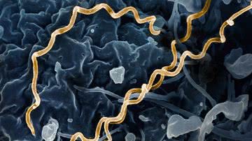 Imagem da bactéria Treponema pallidus, causadora da sífilis - Reprodução/Flickr/NIAID