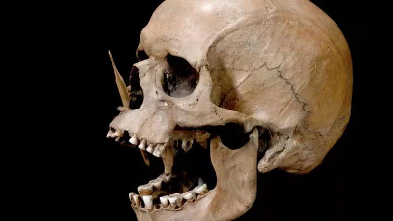 Crânio do esqueleto "Porsmose Man", morto com duas flechas de ponto de osso, na Dinamarca Neolítica - Divulgação/Museu Nacional da Dinamarca
