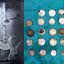 Montagem mostrando imagem de raio-X, e moedas que foram retiradas do corpo do homem