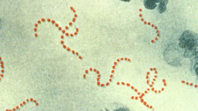 溶連菌感染症は日本で憂慮すべき記録に達している