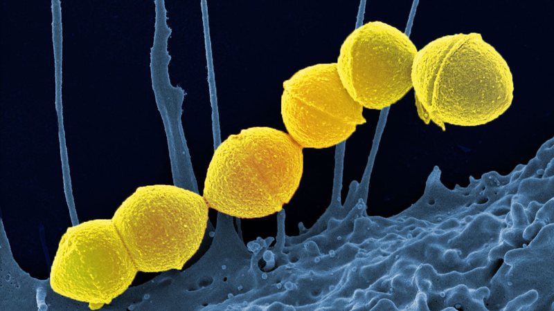 Streptococcus pyogenes - Wikimedia Commons/NIAID