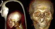A múmia de Amenófis I - Creative Commons / Sahar N. Saleem & Zahi Hawass