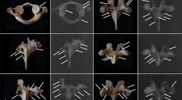 Lesões osteolíticas do homem da Idade do Bronze - Divulgação - Jenna Dittmar/Science Direct