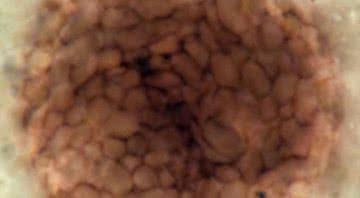 Fotografia mostrando microrganismo espantoso - Divulgação/ Paul Strother