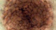 Fotografia mostrando microrganismo espantoso - Divulgação/ Paul Strother