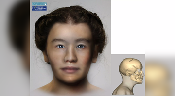 Reconstrução facial da jovem norueguesa que contraiu infecção de Salmonella enterica - Divulgação / Stian Suppersberger Hamre et.al