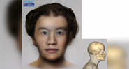 Reconstrução facial da jovem norueguesa que contraiu infecção de Salmonella enterica - Divulgação / Stian Suppersberger Hamre et.al