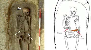 O esqueleto do homem com uma faca no lugar da mão - Divulgação/Micarelli et al./Journal of Anthropological Sciences