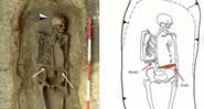 O esqueleto do homem com uma faca no lugar da mão - Divulgação/Micarelli et al./Journal of Anthropological Sciences