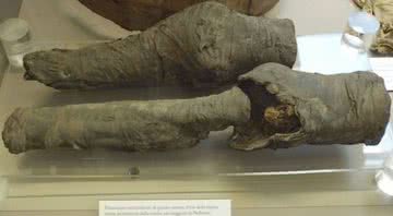 Os joelhos da rainha Nefertari - Divulgação/Habicht et al., PLOS ONE 11