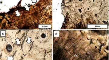 Vestígios de talassemia nos ossos encontrados no Vietnã - Divulgação/Scientific Reports