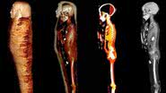 Tomografia de múmia descoberta com coração de ouro no Egito - Cortesia S.N. Saleem, S.A. Seddik, M. El-Halwagy
