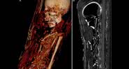Tomografias computadorizadas das múmias egípcias - Divulgação - PLOS One