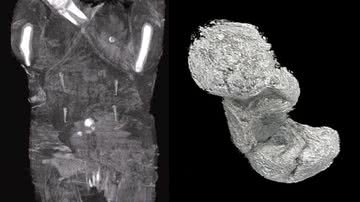 Imagens mostrando a múmia, e o feto que estava dentro dela - Divulgação/ Academia de Ciências da Polônia/ Projeto Múmia de Varsóvia