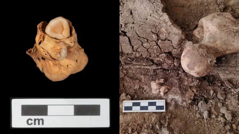 Imagens do teratoma de 3 mil anos encontrado em mulher egípcia - Divulgação/Amarna/Projeto A. Deblauwe / Divulgação/Amarna/Projeto M. Wetzel