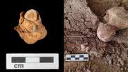 Imagens do teratoma de 3 mil anos encontrado em mulher egípcia - Divulgação/Amarna/Projeto A. Deblauwe / Divulgação/Amarna/Projeto M. Wetzel