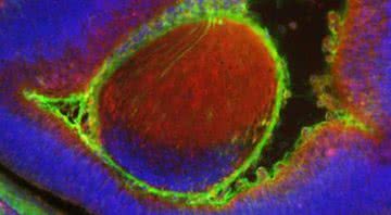 Embrião de rato com células humanas visto na microscopia - Divulgação/ Universidade Estadual de Nova York