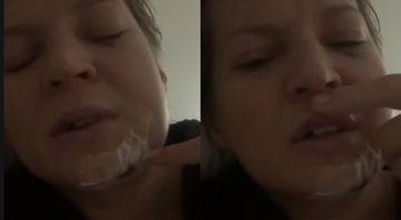 Joice Hasselmann mostrando seus machucados - Divulgação/Youtube/UOL