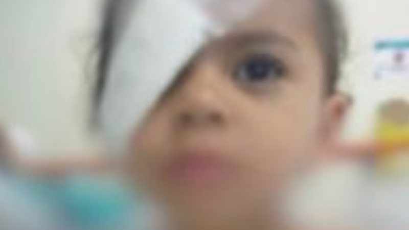 Menina de 2 anos gruda pálpebras acidentalmente - Divulgação/Arquivo pessoal
