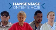 Hanseníase Ontem e Hoje - Editora Caras