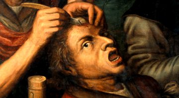 Operação médica na cabeça - Wikimedia Commons