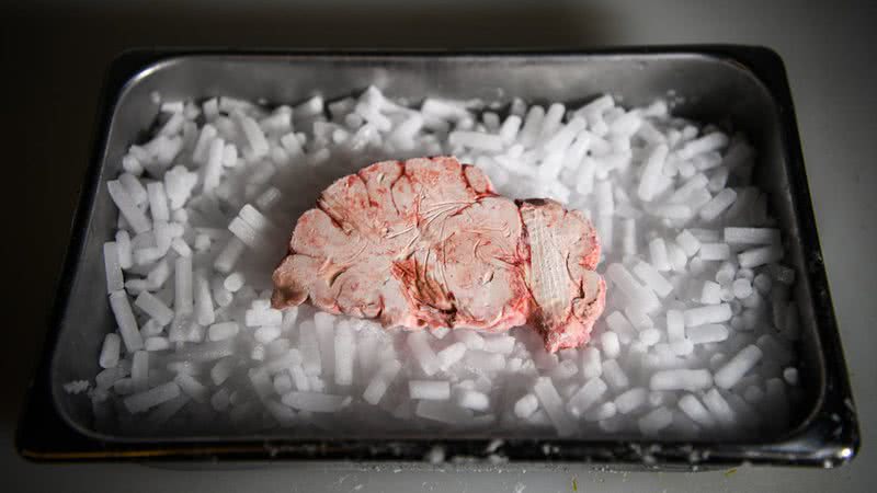 Um cérebro preservado - Getty Images