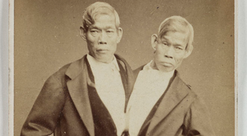 Os irmãos Chang e Eng deram origem ao nome de irmãos siameses - Wikimedia Commons