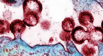 Células humanas infectadas pelo HIV - Divulgação/Instituto Nacional de Alergia e Doenças Infecciosas/National Institutes of Health