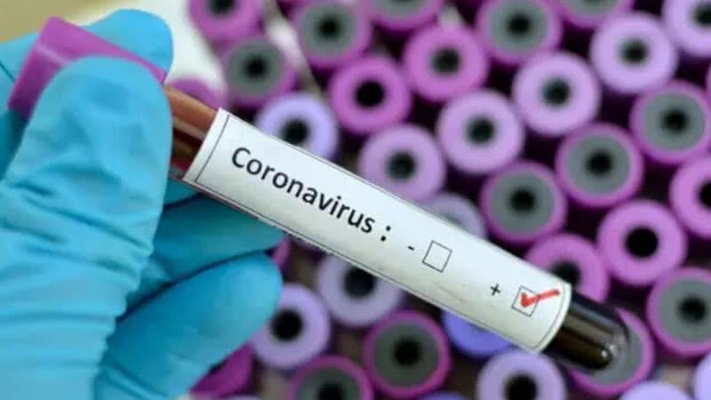 Imagem ilustrativa de um teste positivo para coronavírus