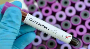 Imagem ilustrativa de teste positivo para o novo coronavírus - Pixabay
