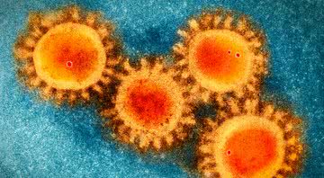 Imagem do Coronavírus em microscópio - Divulgação