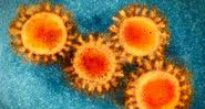 Imagem meramente ilustrativa de vírus em microscópio - Foto de healthcare2021 por Pixabay