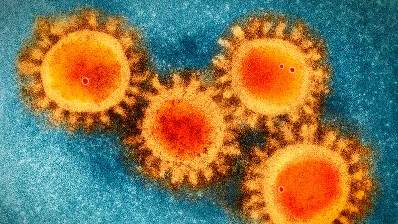 Imagem do Coronavírus em microscópio - Divulgação
