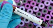 Teste de coronavírus dá positivo - Divulgação