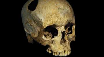 Imagem meramente ilustrativa de um crânio humano - Wikimedia Commons