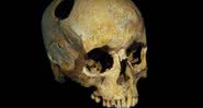 Crânio humano - Wikimedia Commons