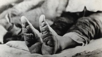 O pé de lótus de uma chinesa - Arfo via Wikimedia Commons