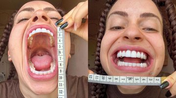 Fotos de Xehli G mostrando a boca ao lado de uma fita métrica - Reprodução/Instagram