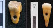 Os dois dentes encontrados em Çatalhöyük - Universidade de Copenhagen