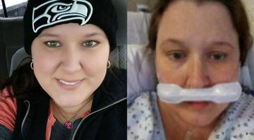 Natalie em fotografias antes e durante o tratamento - Divulgação / Facebook / Natalie Rise