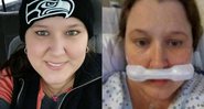 Natalie em fotografias antes e durante o tratamento - Divulgação / Facebook / Natalie Rise