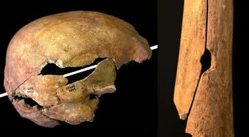 Duas perfurações identificadas pela equipe de pesquisa; uma no crânio, outra no fêmur - Oliver Creighton / Universidade de Exeter