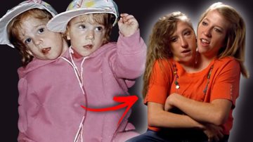 Montagem de Abby e Brittany na infância e em foto recente - Divulgação / Vídeo / OWN