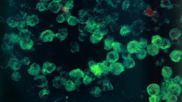 Detalhes da ameba Naegleria fowleri, conhecida como 'comedora de cérebros' - Divulgação/CDC